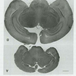 Western Blot Analysis Of Mouse Whole Brain Homogenates Using Anti Bax