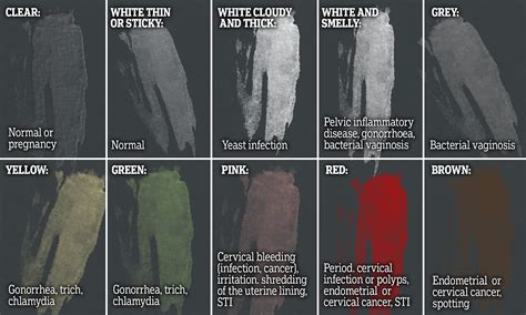 Mucus Green and Yellow Discharge Explain Difference