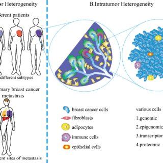 Schematic Of Breast Cancer Microenvironment Breast Cancer Cells