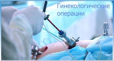 Спринцовка как выглядит гинекологическая фото