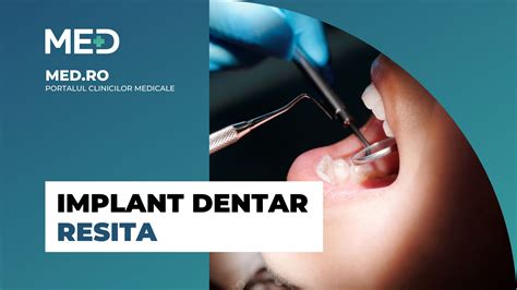 Implant dentar Resita Top 3 Clinici Prețuri Programare Online