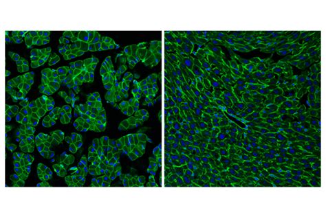 Ras E K L Rabbit Mab Bsa And Azide Free Cell Signaling Technology