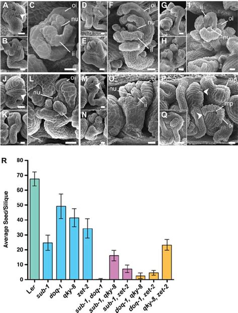 Comparison Of Ovule Morphology In Different Slm Double Mutants Sem