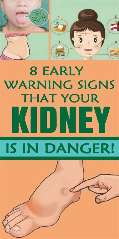 8 Warning Symptoms of Kidney Damage - Quoqlee