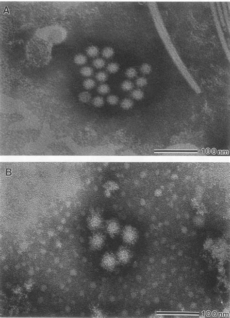 A Electron Micrograph Of Srsv 9 Particles In Stool Specimen B