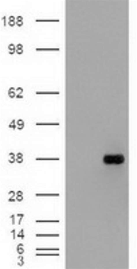 OriGene EPCAM Mouse Monoclonal Antibody Clone ID OTI2G1 Quantity