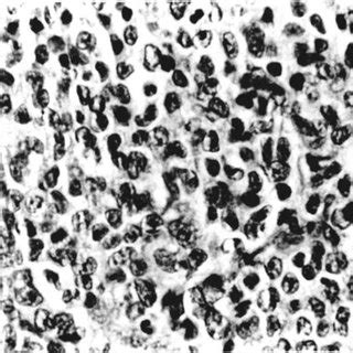 section  lymph node illustrating typical appearance  granulocytic