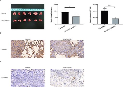 Knockdown of TLX1NB suppressed pulmonary metastasis of SW620 cells in ...