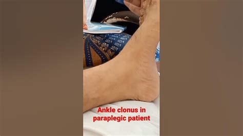 Ankle Clonus In Paraplegic Patientmbbsmbbsmotivation Clinicalcases