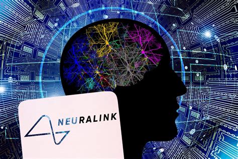 Elon Musk S Neuralink Seeking Volunteer For First Trial Of Brain