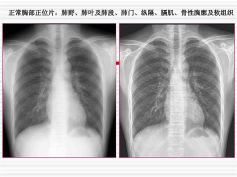 X线和ct诊断word文档免费下载文档大全