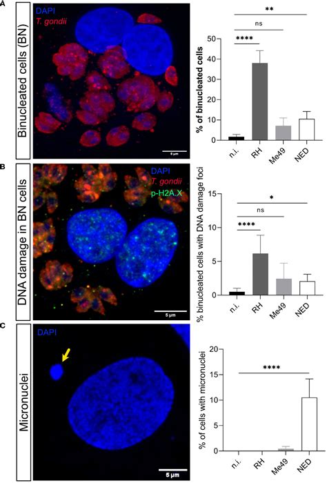 Toxoplasma Gondii Infection Induced Host Cellular Dna Damage Is Strain