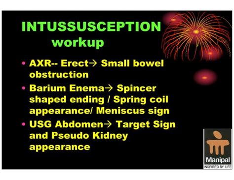 Pediatric Intussusception An Overview Ppt