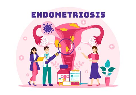 Endometriosis Vector Illustration With Condition The Endometrium Grows
