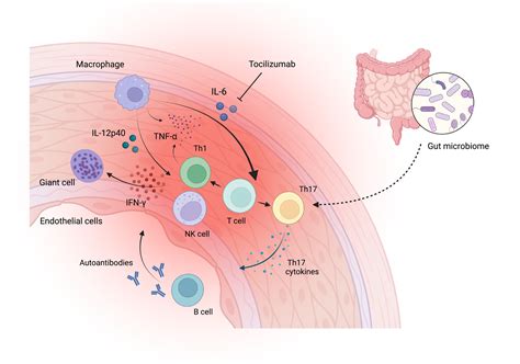 biomarkers  takayasu arteritis     promising