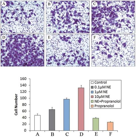 Cell Invasion Assay In Pancreatic Cancer Cell Line Miapaca 2 Ne 1 And