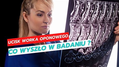 Ucisk worka oponowego Co wyszło w badaniu YouTube