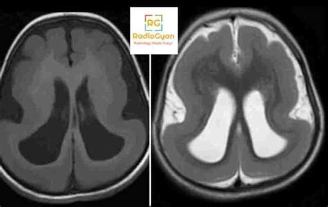 Radiology Board Review Cases Spotters Set Radiogyan Radiogyan