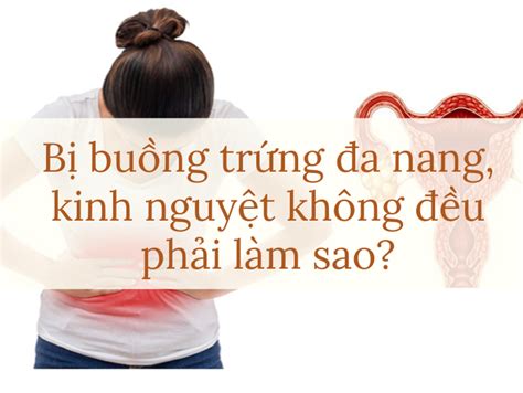 B Bu Ng Tr Ng A Nang Kinh Nguy T Kh Ng U Ph I L M Sao