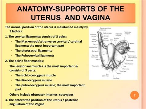 Pelvic Organ Prolapse Ppt