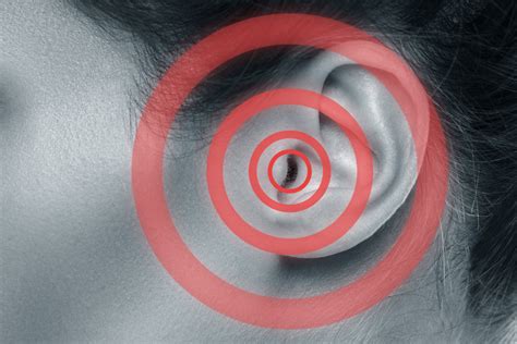 What Is Tinnitus Retraining Therapy Hearing Associates Of Las Vegas