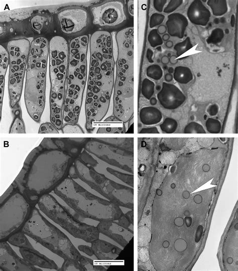 Electron Micrographs Of Leaf Palisade Tissue From A HLB Affected And