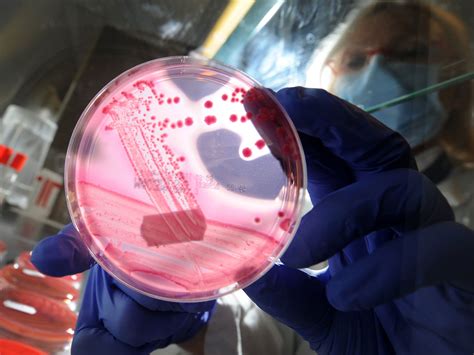 ancient bacteria   elixir  life    elderly mice