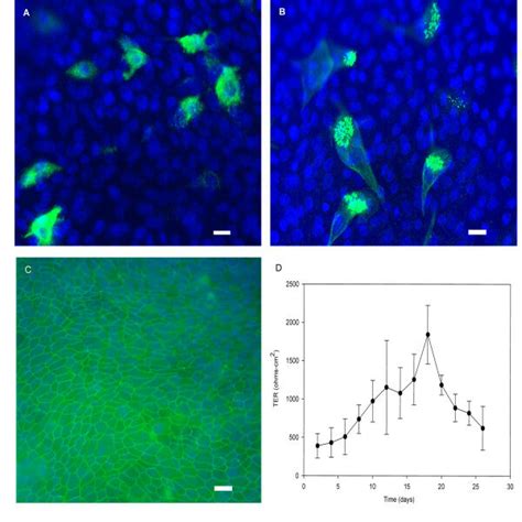 Phenotypic Markers Of Human Small Airway Epithelial Cells SAECs