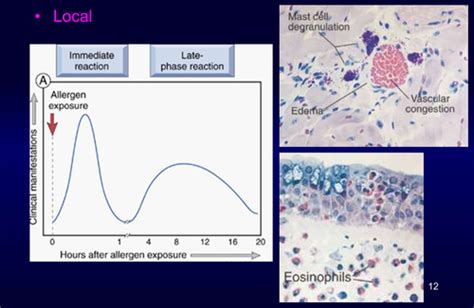 Path Lectures Diseases Of Immunity Flashcards Quizlet