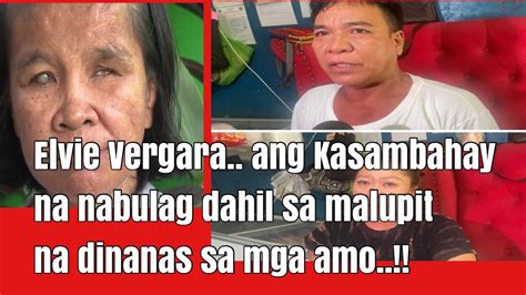 Elvie Vergara Ang Kasambahay Na Nabulag Dahil Sa Malupit Na Dinanas Sa