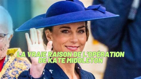 Exclusif La V Rit Derri Re L Op Ration De Kate Middleton Un Expert