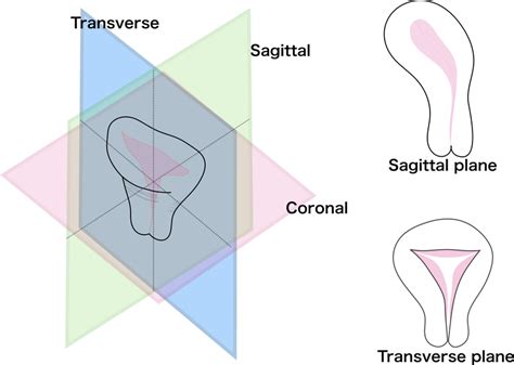 Definition Of Sagittal And Transverse Magnetic Resonance Imaging Download Scientific Diagram