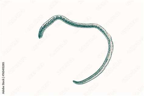Schistosoma Japonicum Is A Parasite That Causes Human Schistosomiasis