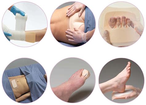 Foam Dressing For Bed Sores