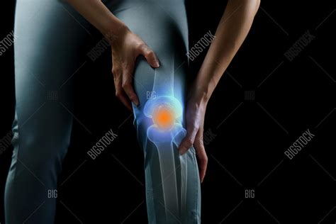 Knee Pain Avenue Chiropractic Clinic Southampton