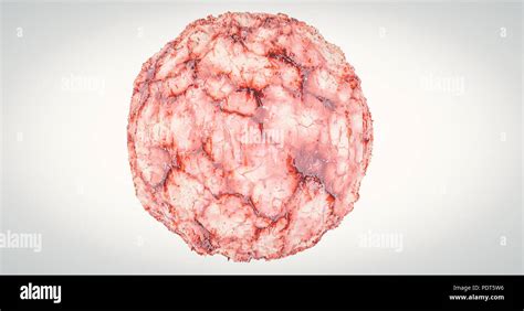 Cancer Cell Oncology Concept Cancer Tumor Cyst Carcinoma Lymphoma Colon Cancer Brest Cancers 3d