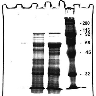 RP HPLC Protein Profile Of Defatted Peanut Phosphate Extract Yellow Vs