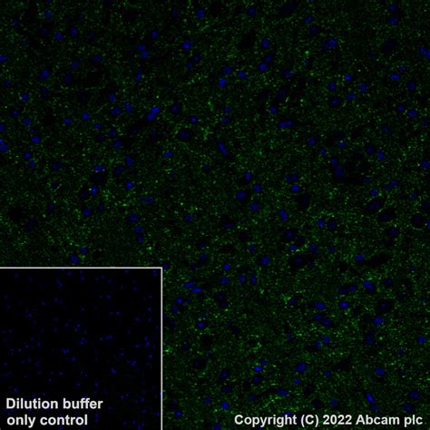 Alexa Fluor 488 Alexa Fluor 488 Rabbit Monoclonal EPR20578 To GAD67