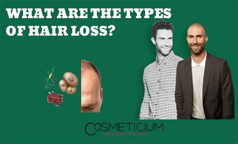 What Are The Types Of Hair Loss Cosmeticium Blog