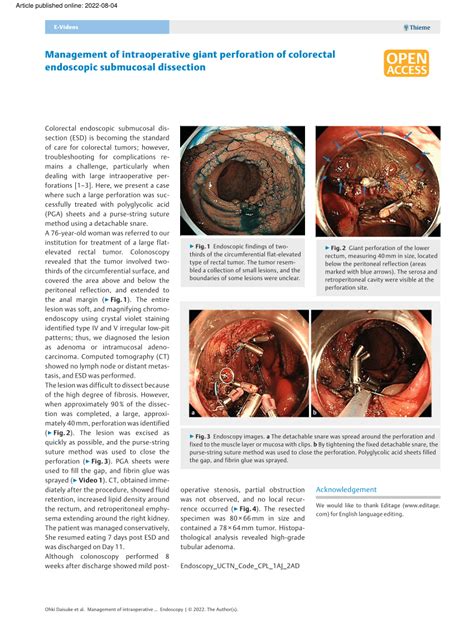 Pdf Management Of Intraoperative Giant Perforation Of Colorectal Endoscopic Submucosal Dissection