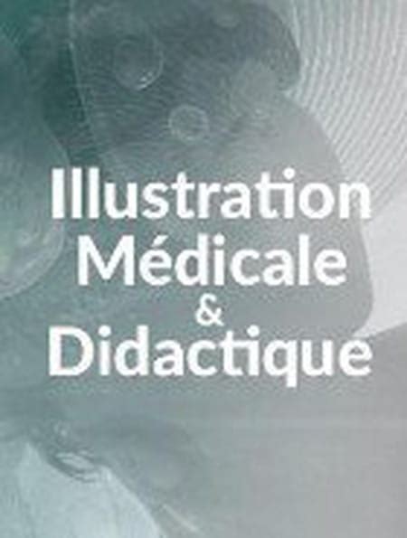 Sophie Jacopin ILLUSTRATION MEDICALE Sophie Jacopin Illustration