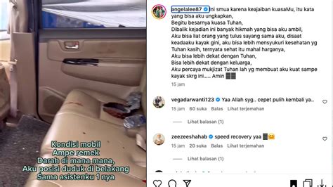 Angela Lee Ungkap Kronologi Kecelakaan Yang Hampir Merenggut Nyawanya