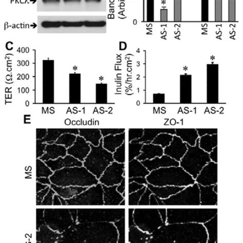 Inhibition Of Pkc Activity Disrupts Tight Junctions In Caco Cell