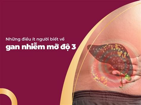 Gan Nhiễm Mỡ Độ 3 Mối Nguy Cơ Cho Sức Khỏe Cần Chữa Trị Ngay BIDIPHAR