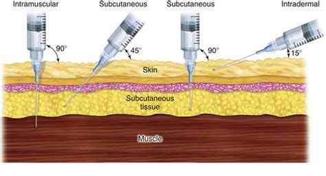 Nsg 1600 Intramuscular And Subcutaneous Injections Flashcards Quizlet