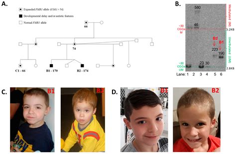 Ijms Free Full Text Significantly Elevated Fmr1 Mrna And Mosaicism