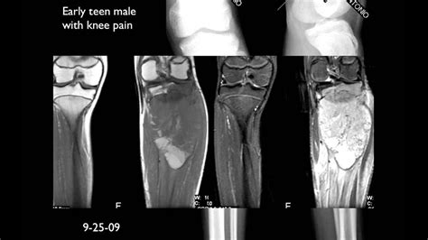 Phương Pháp Chụp MRI Là Gì Và Chụp MRI Biết được Bệnh Gì? | Medlatec