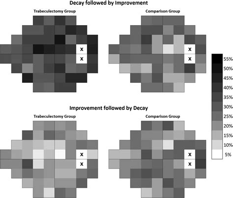 Trabeculectomy Can Improve Long Term Visual Function In Glaucoma