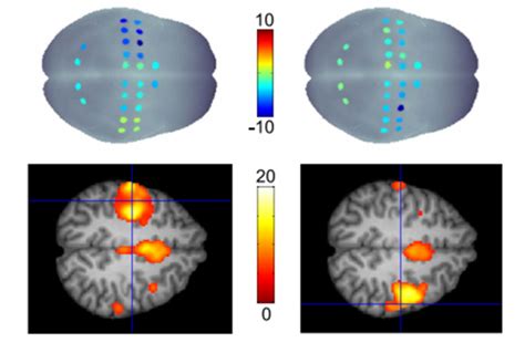 Fnirs Fmri Concurrent Nirs Mri Recording Measurements Experiments