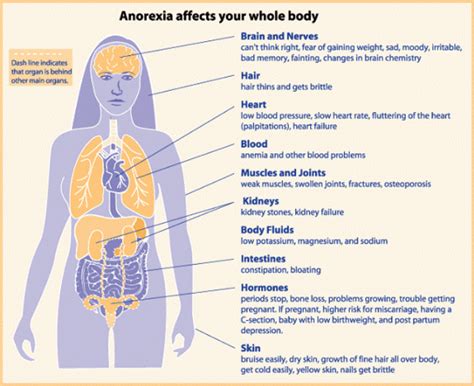 Signs & Symptoms - ANOREXIA NERVOSA